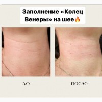 Косметолог Елена с медицинским образованием